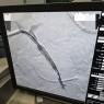 Estenosis de la vena porta con stent